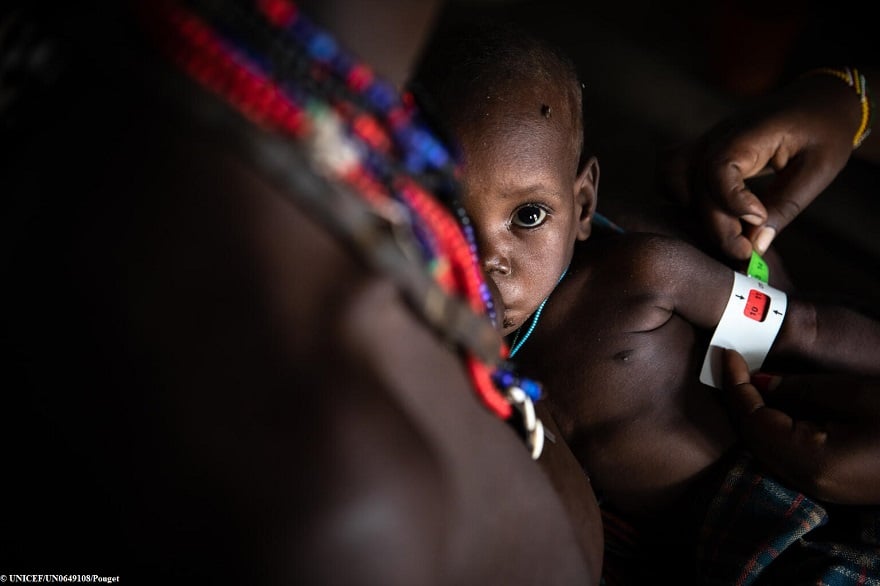 Somalia: más de 500.000 niños en riesgo de muerte por desnutrición