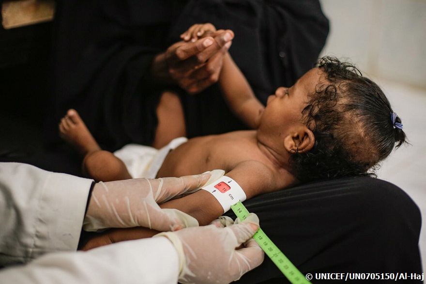 Yemen: incrementan la desnutrición y la inseguridad alimentaria