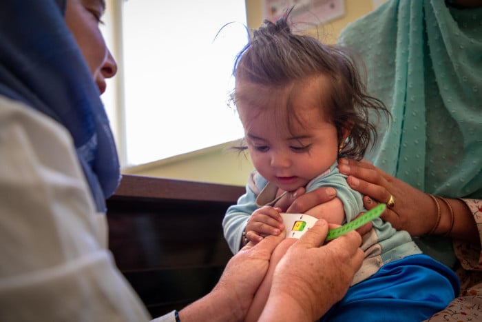 Afganistán: 3,7 millones de niños en riesgo de desnutrición