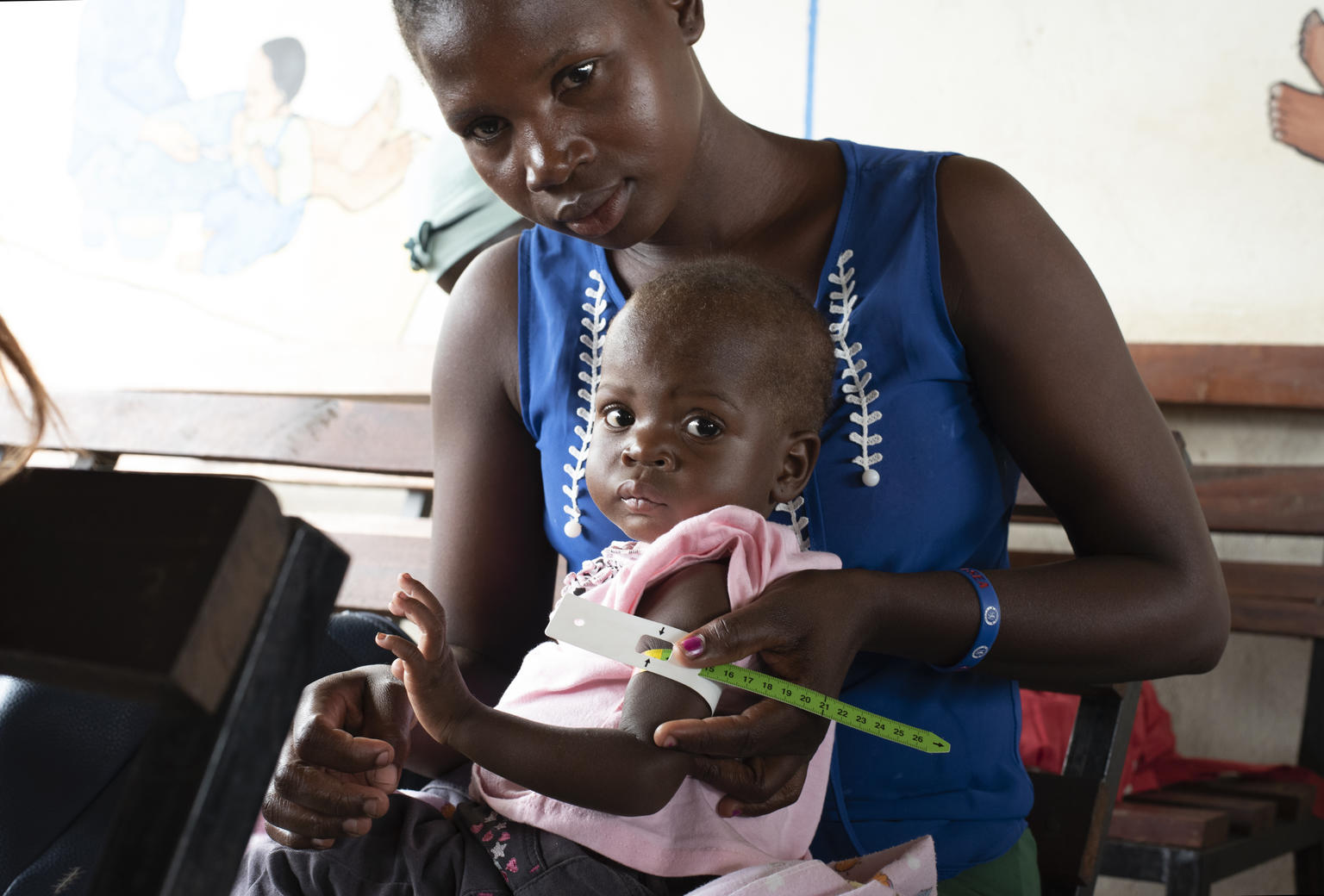 Las agencias de Naciones Unidas piden una mayor respuesta para hacer frente al aumento del hambre y la desnutrición en Sudán del Sur