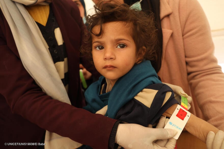 A Leen, de 2 años, le miden el perímetro medio braquial (PMC); su PMC es inferior a 10, lo que indica desnutrición aguda grave.