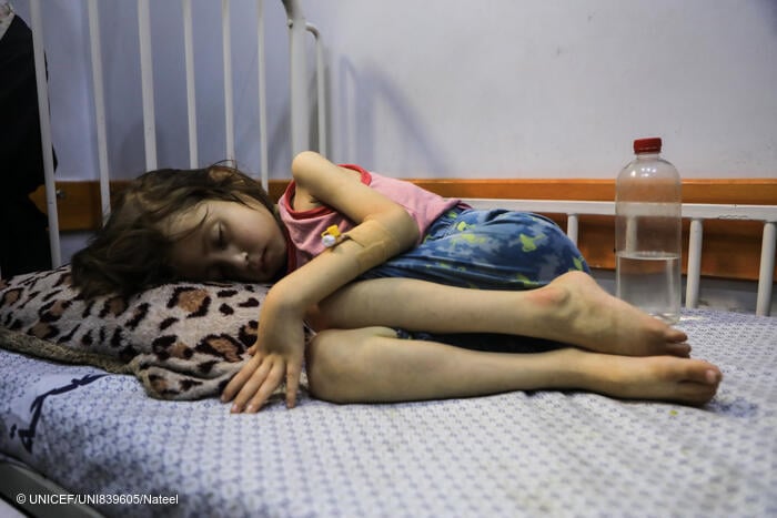 Una niña que sufre desnutrición yace en una cama del Hospital de la Sociedad de Pacientes en la ciudad de Gaza el 29 de julio de 2025