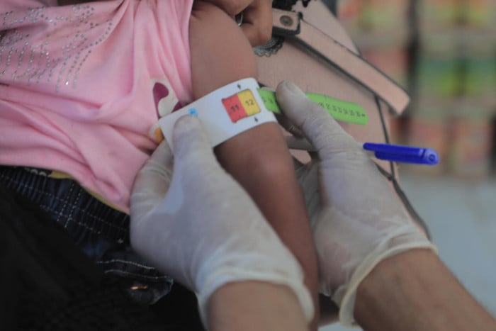 ¿Qué es el hambre y por qué sigue afectando a millones de niños en el mundo?