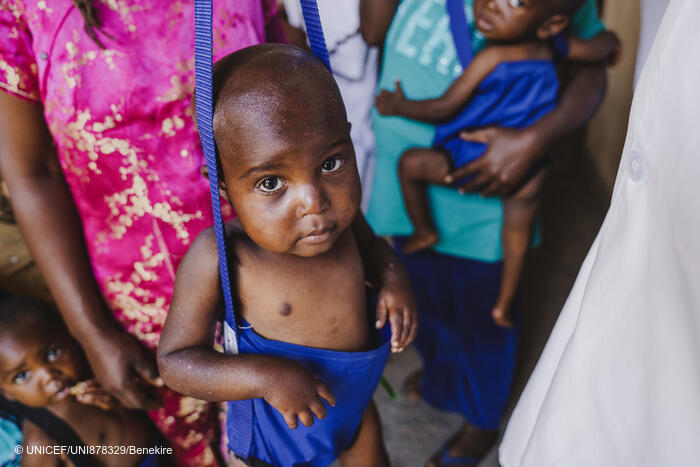 Justine, de 4 años, es atendida en el centro de salud Umoja de Goma (provincia de Kivu del Norte, República Democrática del Congo).