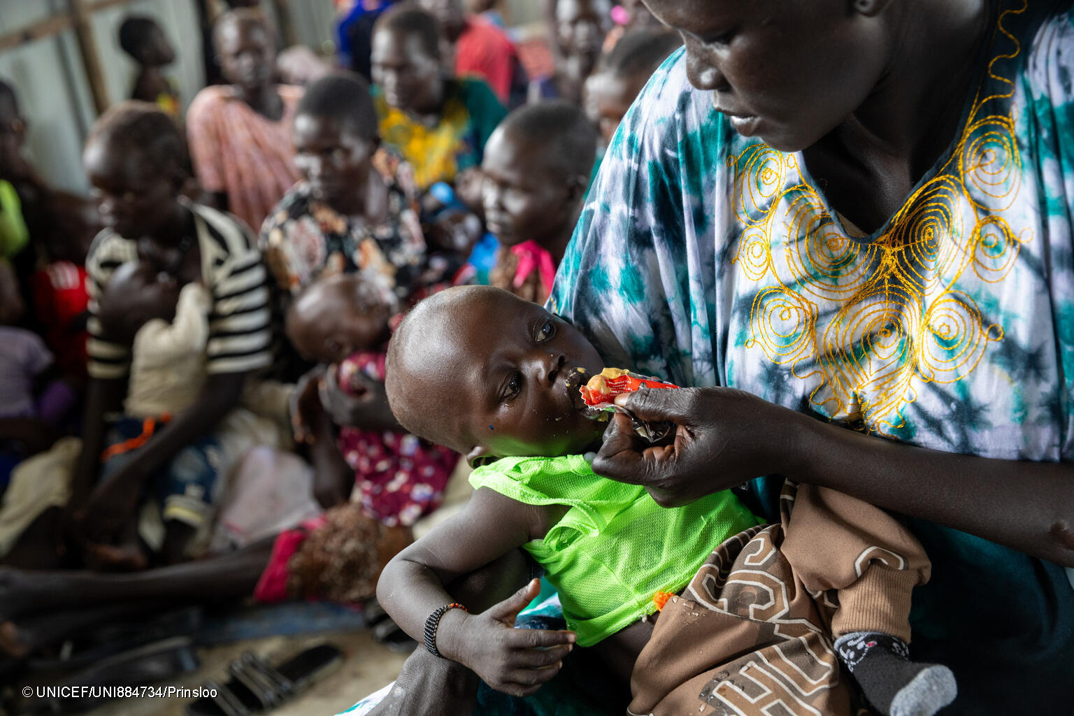 un bebé recibe un sobre de alimento terapéutico distribuido por Unicef, de las manos de su madre en Sudán del Sur