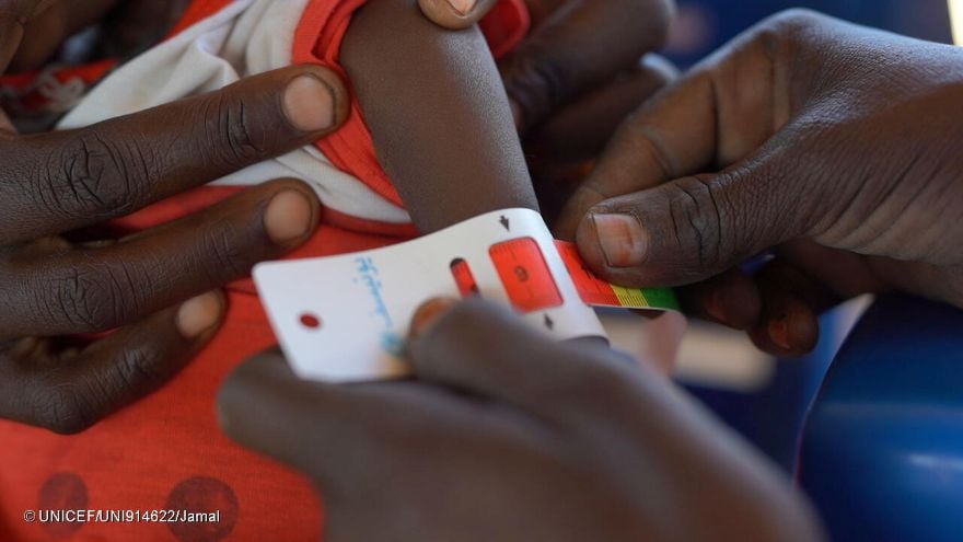 Sudán: una encuesta nutricional en Um Baru (Darfur del Norte) halla un 53% de desnutrición aguda en menores de cinco años