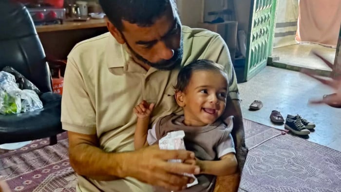 Desnutrición infantil en Gaza