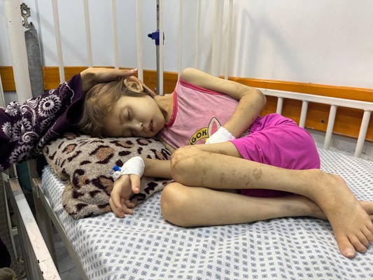 UNICEF: “Una hora en una clínica de Gaza disipa cualquier duda sobre si hay hambruna”