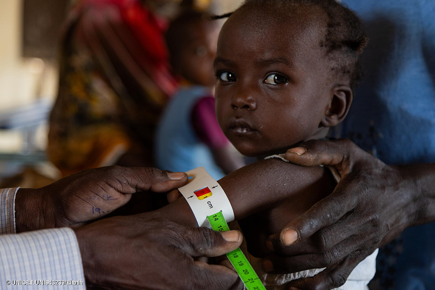 bebé sudanés desnutrido