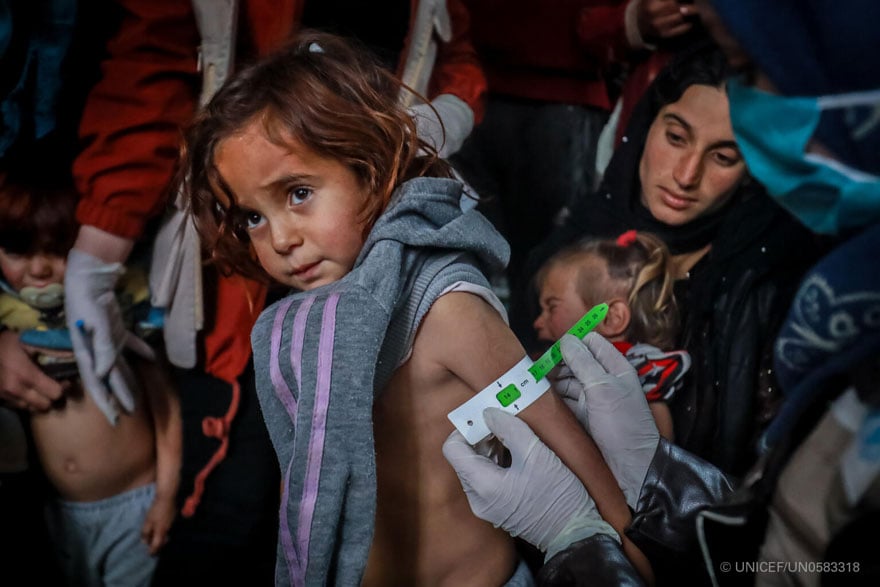 Personal sanitario examina a los niños para comprobar su nivel de desnutrición en Siria