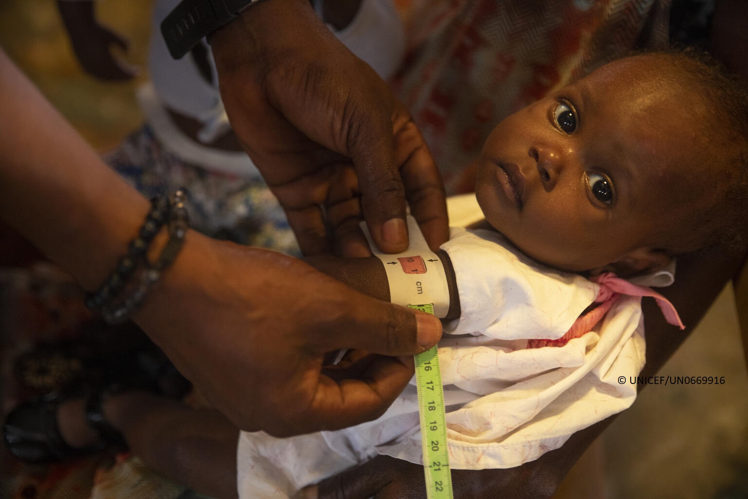 Personal humanitario mide la circunferencia del brazo de un bebé en Haití