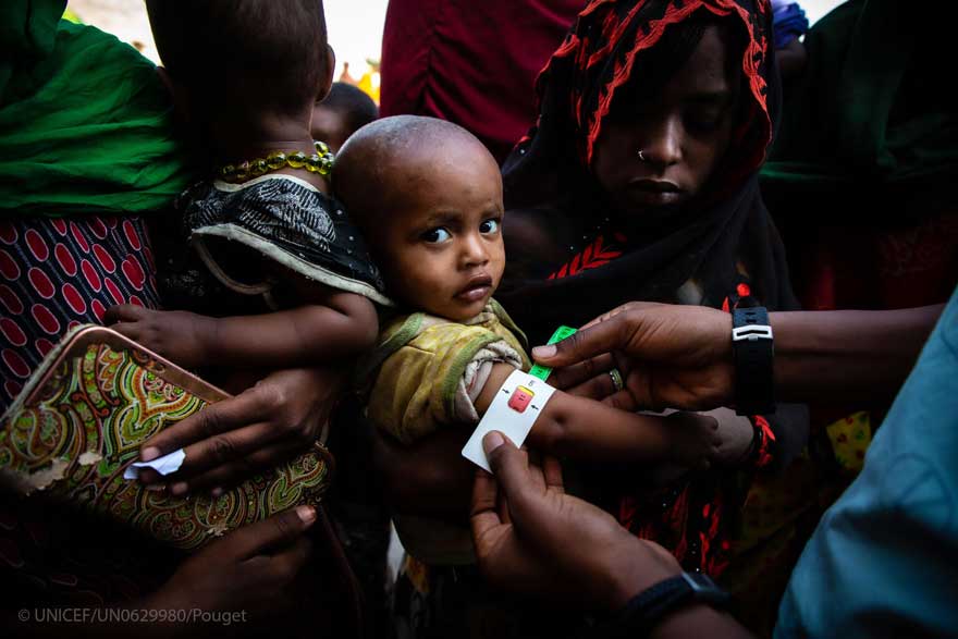 Profesionales sanitarios miden la circunferencia del brazo de un niño en Etiopía