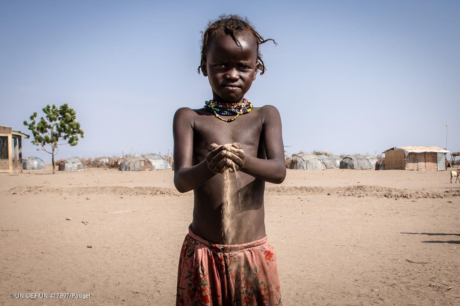 Un niño afectado por la sequía en Etiopía