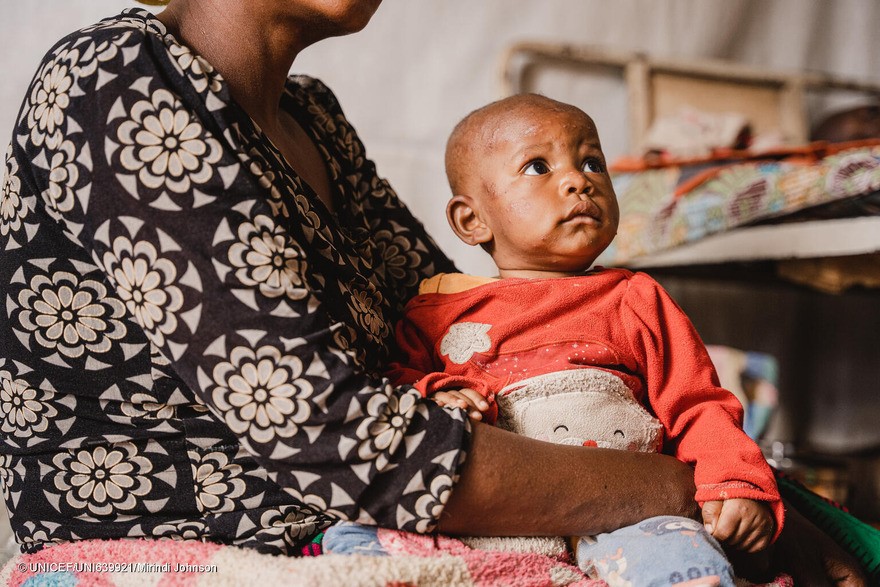 Merci, de 6 meses, acunada por su madre, Furaha, en la unidad de aislamiento y tratamiento de la viruela en el hospital Kavumu, apoyado por UNICEF, en la zona de salud de Miti-Murhesa, provincia de Kivu del Sur, RD del Congo, el 4 de septiembre de 2024.