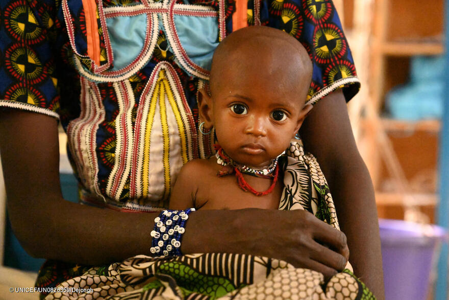 Un bebé con desnutrición afectado por la crisis en Níger