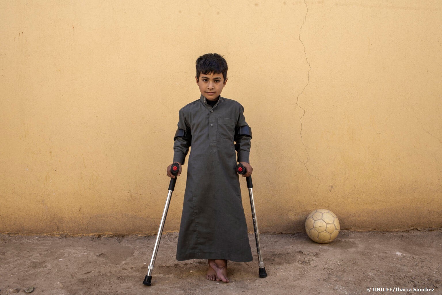 Un niño herido en un ataque en Irak