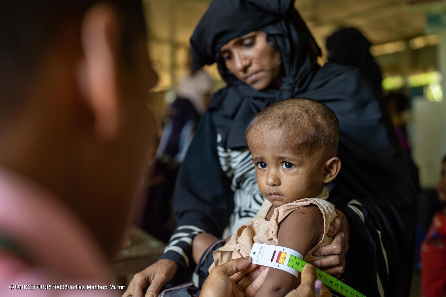 Evaluación de la desnutrición aguda de un niño en un campamento rohingya mediante una cinta MUAC.