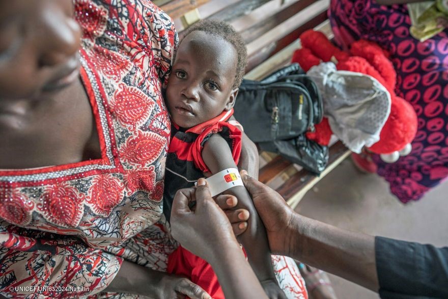 Un niño es evaluado por desnutrición en una clínica nutricional respaldada por UNICEF, en el Centro de Atención Primaria Kimu, en Juba (Sudán del Sur).