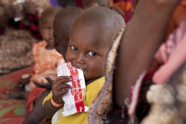Imagen de un niño con una bolsa de alimento terapéutico