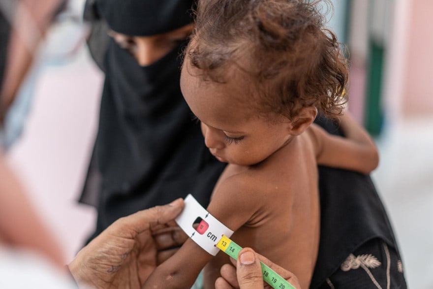 yemen-desnutricion