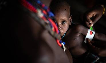 Somalia: más de 500.000 niños en riesgo de muerte por desnutrición