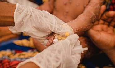 UNICEF publica una licitación de emergencia para conseguir vacunas contra la mpox