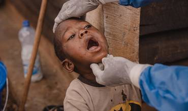 Viruela del mono en República Democrática del Congo