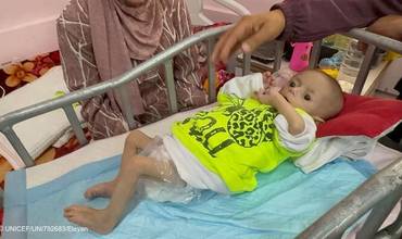 Una niña gravemente desnutrida recibe cuidados en un hospital de Khan Younis, Gaza