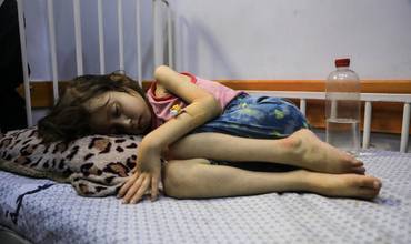 Una niña que sufre desnutrición yace en una cama del Hospital de la Sociedad de Pacientes en la ciudad de Gaza el 29 de julio de 2025