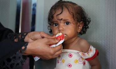 En Yemen, la desnutrición marca la vida de muchos niños 