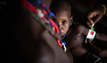 Medición de la circunferencia del brazo para detectar desnutrición.