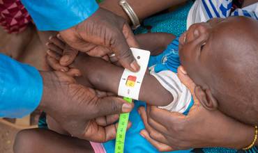 Hassan, de 18 meses, en un control de su estado nutricional en Burkina Faso.
