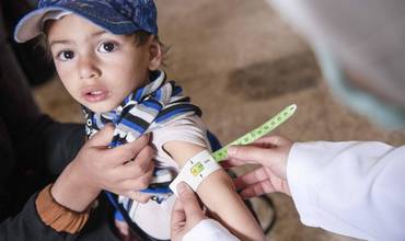 Ishak en un control para detectar la desnutrición aguda.