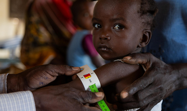bebé sudanés desnutrido