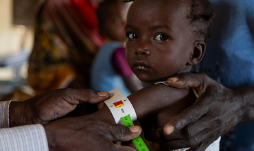 bebé sudanés desnutrido