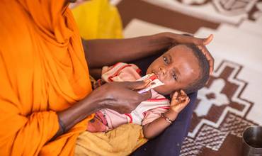 Un niño recibe tratamiento contra la desnutrición en un campo de desplazados de Etiopía