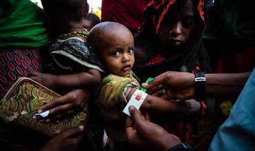 Profesionales sanitarios miden la circunferencia del brazo de un niño en Etiopía