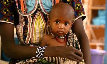 Un bebé con desnutrición afectado por la crisis en Níger