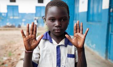 Un niño muestra sus manos recién lavadas en RDC
