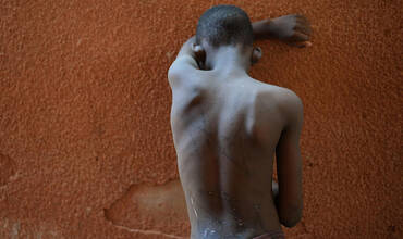 Un niño víctima de violencia doméstica en Burkina Faso