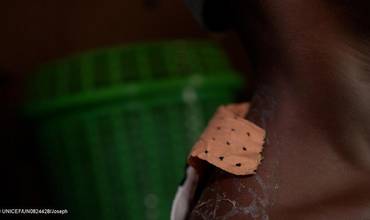 Una niña herida a causa de la violencia en Haití