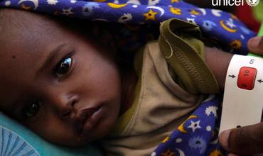 Sequía en Etiopía: 6 millones de niños están en peligro