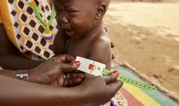 Akot se recupera de la desnutrición en Sudán del Sur.