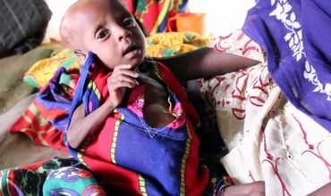 Combatiendo la desnutrición en Chad