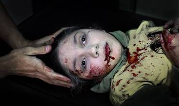 Crisis de Siria: los rostros de la guerra 