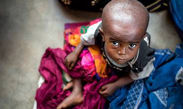 República Democrática del Congo: 400.000 niños en riesgo por desnutrición