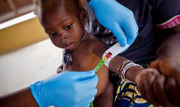 ¿Cómo se diagnostica la desnutrición infantil?