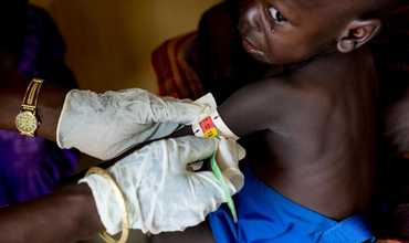 Sudán del Sur: 1 de cada 3 niños está desnutrido en las áreas más golpeadas por la violencia