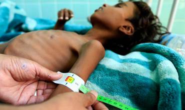 ¿Por qué los niños de Yemen están muriendo de hambre?