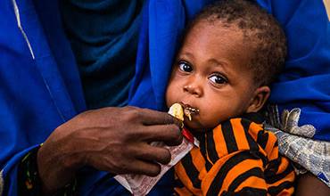 ¿Qué es la desnutrición?